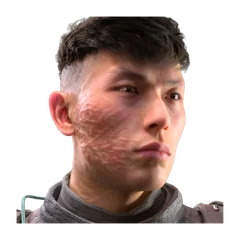 Burn Scar